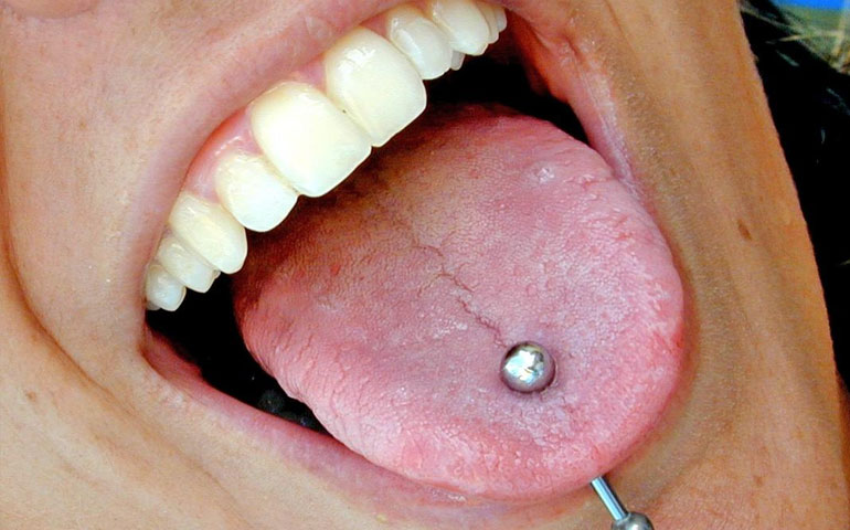 El 70% de los piercing que se colocan en la boca generan complicaciones